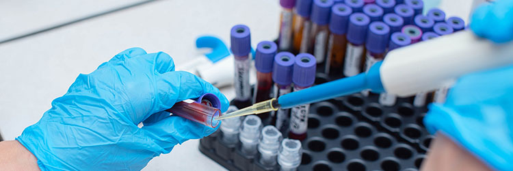 臨床検査技師・求人